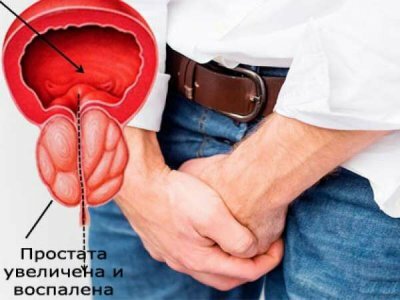 Если у тебя простатит или часто бегаешь в туалет, срочно возьми еврейский...